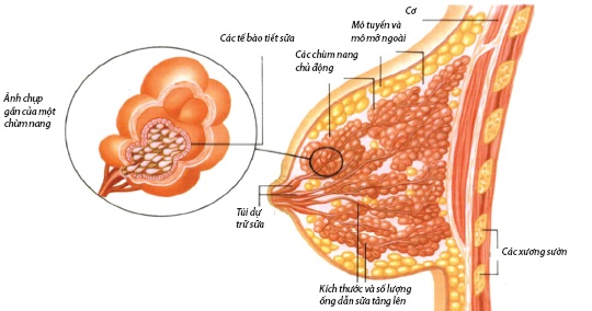 Fibrocystic - Hình ảnh minh họa